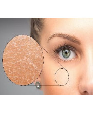 Peau sèche & sensible